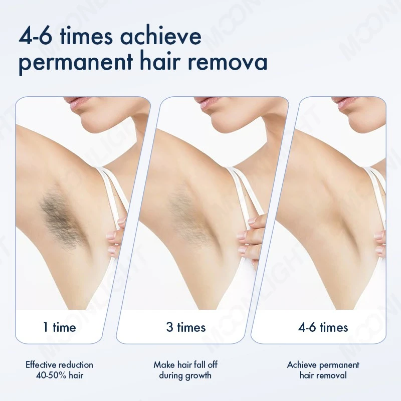 2-in-1 ND YAG + Diode Laser Hair Removal Machines high quality