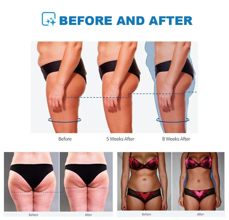 2026 Latest EMS + RF Body Sculpting Machine suppliers