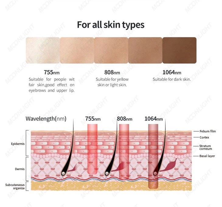 2400w Hair Removal Laser Machine For Beauty Salon