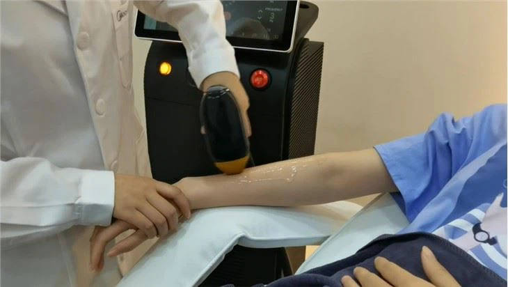 آلة إزالة الشعر بالليزر ديود الألياف البصرية