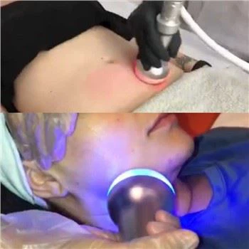 آلة التخسيس بالتبريد