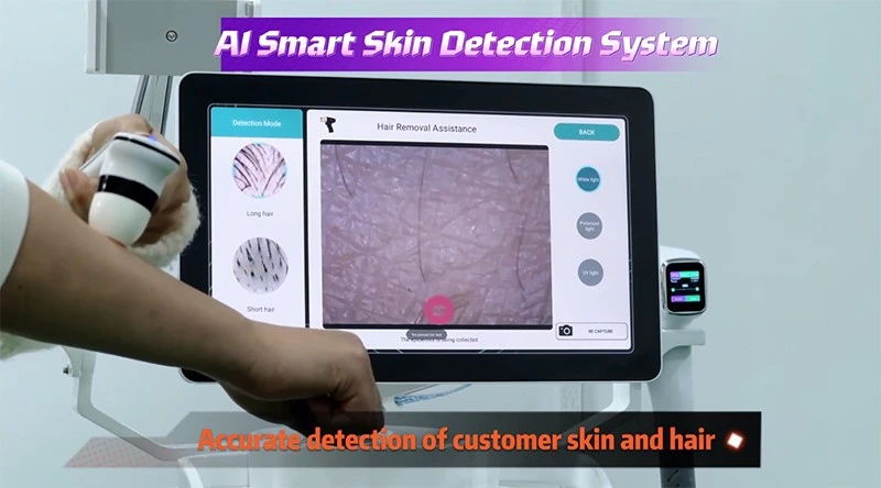 Multi-Wavelength Diode Laser Hair Removal Machine