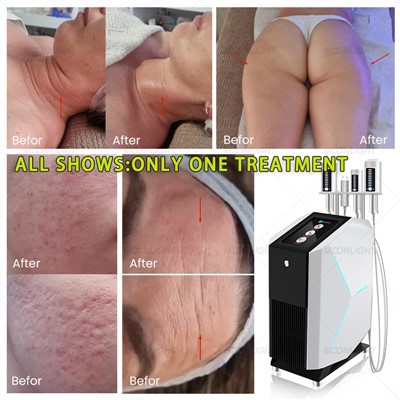 العلاج بالرولات سليم سفير