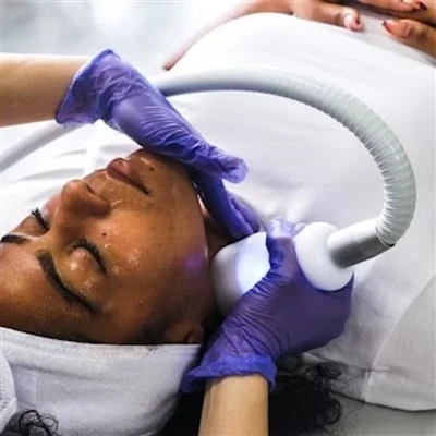 شد الجلد باستخدام جهاز تجميد الوجه Cryoskin
